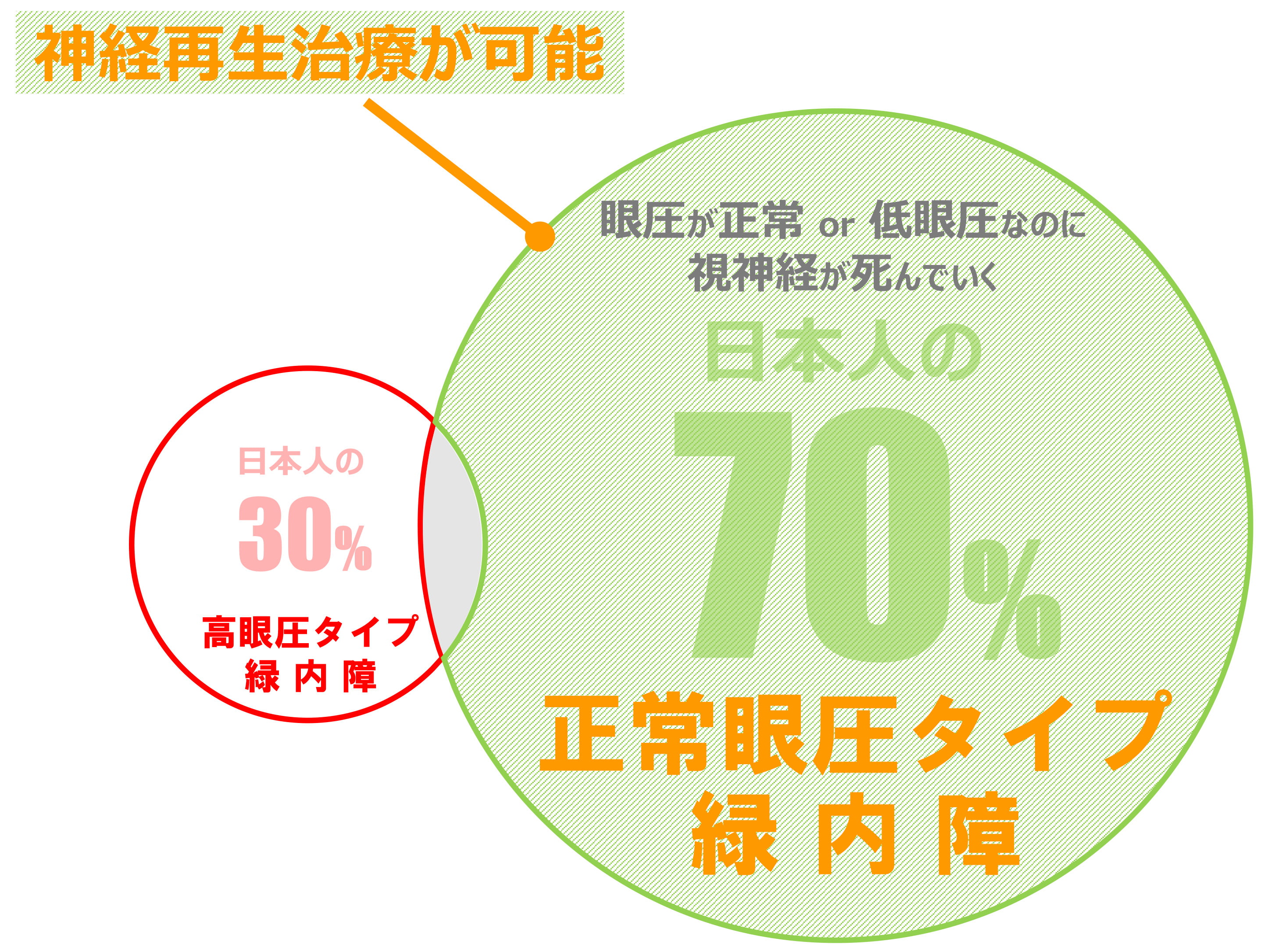 眼圧が正常 or 低眼圧なのに視神経が死んでいく日本人の70%正常眼圧タイプ緑内障 神経再生治療が可能